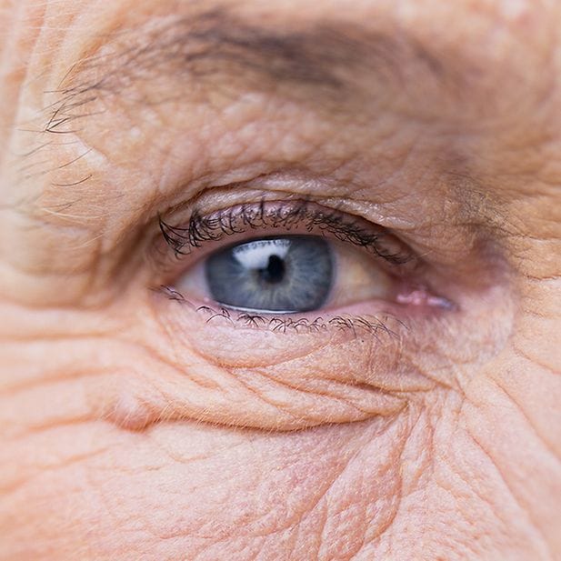 Eye_colour_row_7
