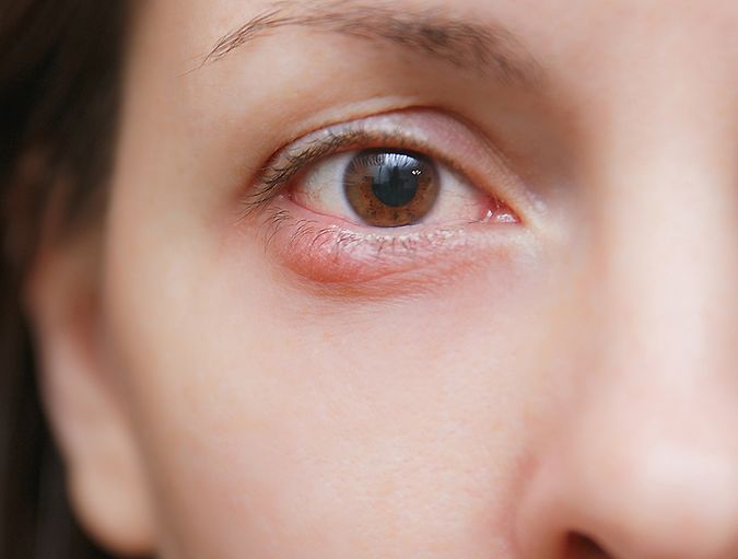Contact_lenses_and_stye_row_1