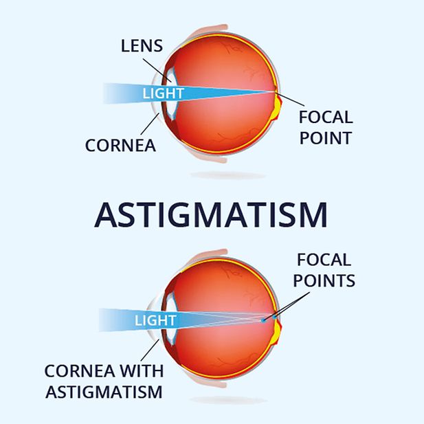 What_is_astigmatism_row_3